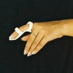 Frog Splint (Alpha)